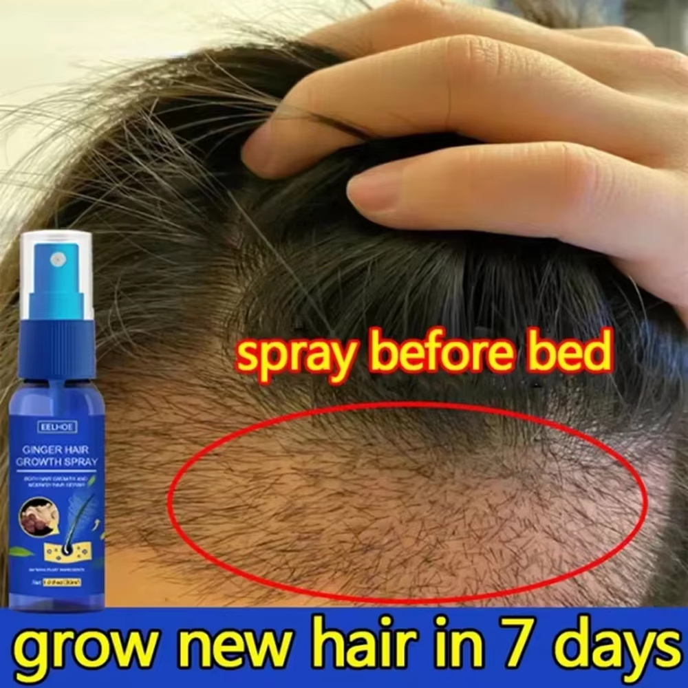Hair Growth Serum Oil - Fast Ginger Hair Growth Spray Roots