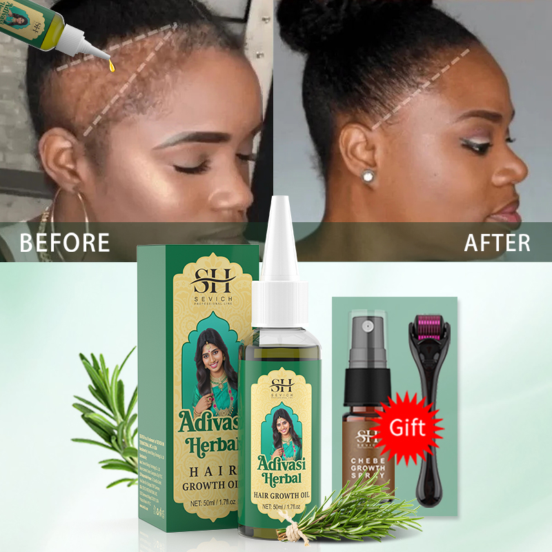 Ayurvedic Hair Growth Oil Indi - Hair Care Essence Oil 评论和价格