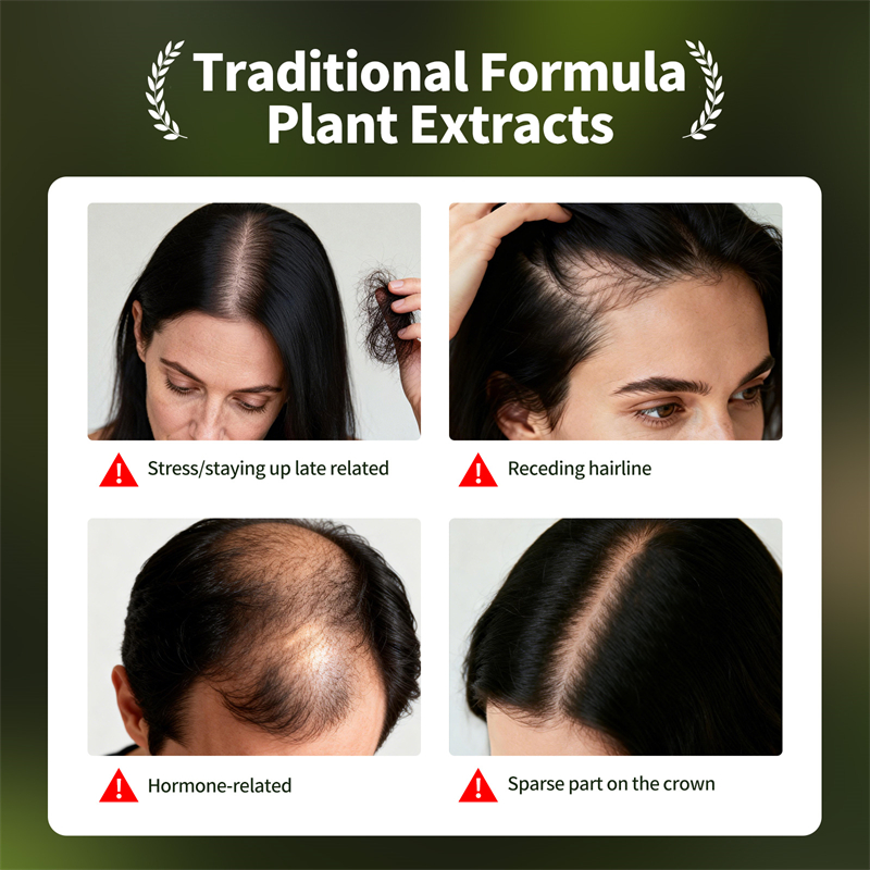 Natural Hair Growth Set Usman  - Hair Care Herbal 评论和价格