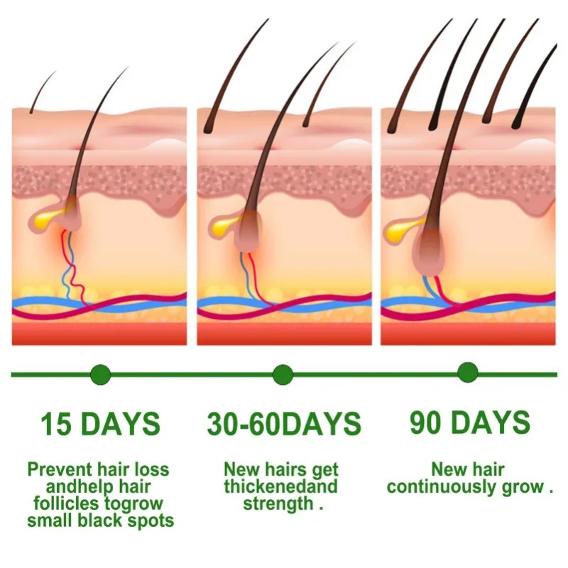 Hair Growth Serum Fast Growing - Hair Care Essence Oil 评论和价格
