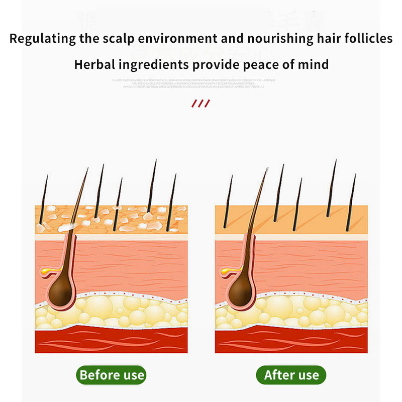 Sophora Flavescens Hair Follic - Hair Care Cream 评论和价格