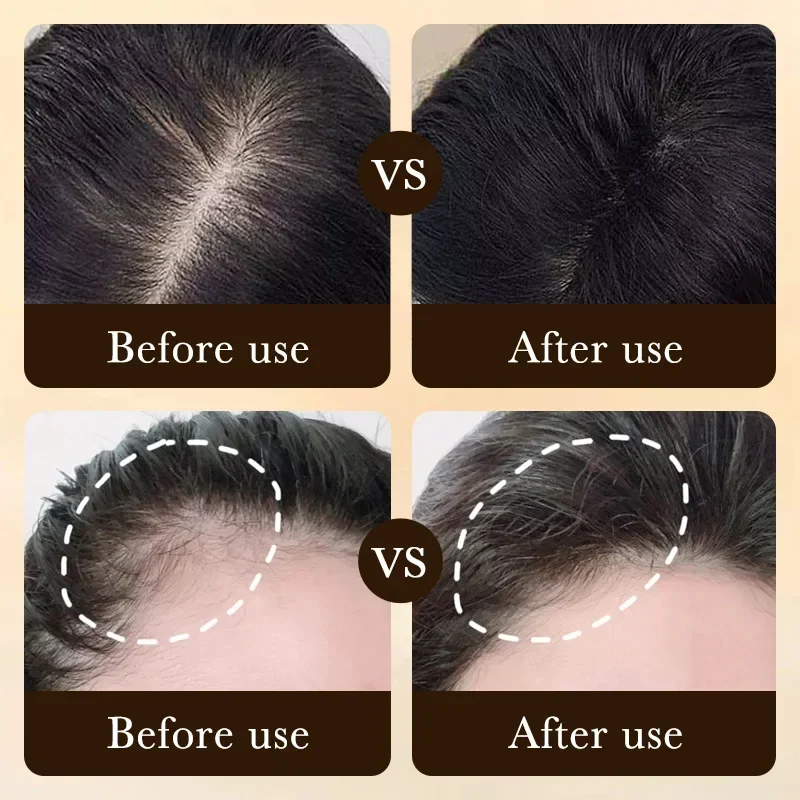 Biotin Fast Hair Growth Oil Pr - Hair Care Essence Oil 评论和价格