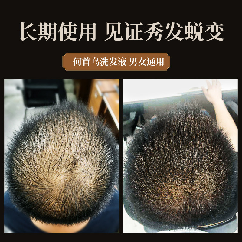 300ml Polygonum multiflorum sh - Hair Care Herbal 评论和价格