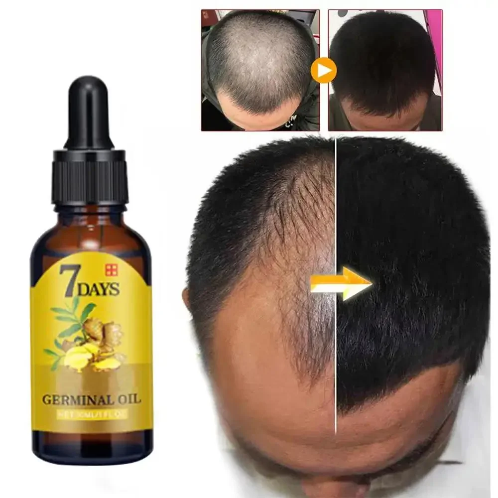 Hair Growth Ginger Fast Growin - Hair Care Essence Oil 评论和价格