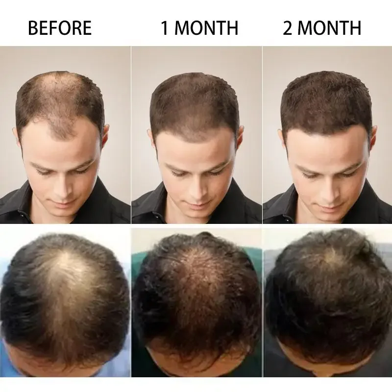 Hair Growth Ginger Fast Growin - Hair Care Essence Oil 评论和价格