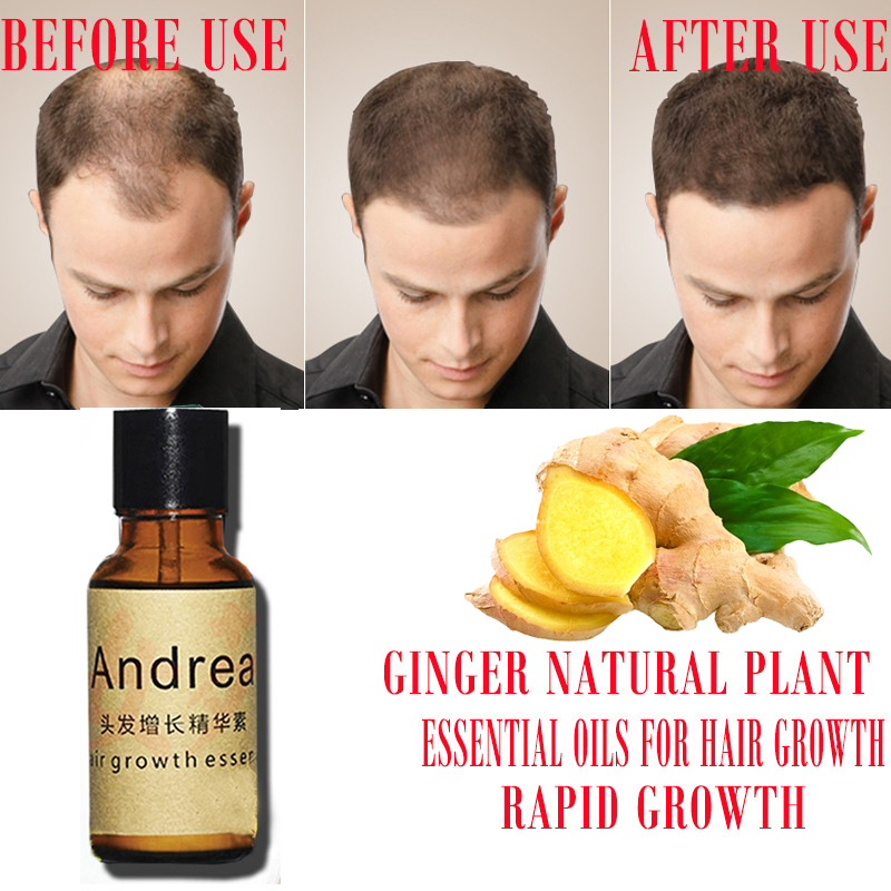 2/5/10Pcs Andrea Hair Growth S - Hair Care Herbal 评论和价格