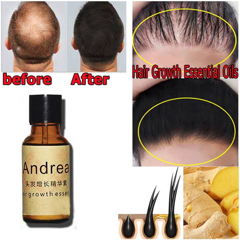 2/5/10Pcs Andrea Hair Growth S - Hair Care Herbal 评论和价格