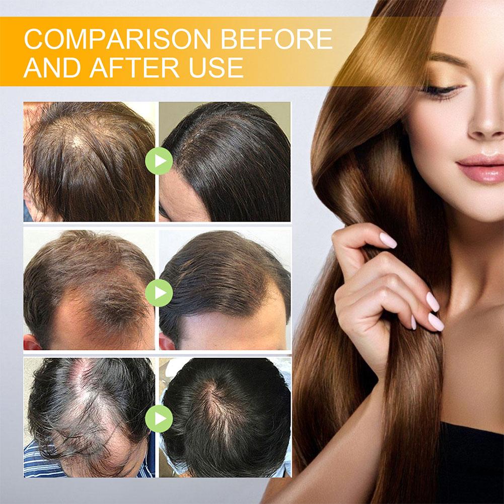 5/3/1pcs Biotin Fast Hair Grow - Hair Care Herbal 评论和价格